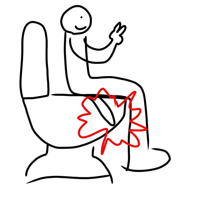 This is a simple hand-drawn stick figure meme depicting a person using a public toilet. The figure smiles and holds up a casual peace sign, giving an outward impression of being unbothered. However, the toilet seat has a large crack directly between the figure's legs, highlighted with jagged red lines that indicate the crack is painfully pinching the person's skin. The joke plays on the relatable unpleasant surprise of encountering a broken, uncomfortable toilet seat in a public restroom, and the contrast between appearing fine while experiencing a hidden, awkward painful situation.