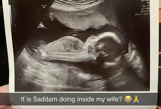 The image features a real ultrasound scan of a fetus, held by a hand. At the bottom, a humorous text overlay reads: 'tf is Saddam doing inside my wife? 😂🙏'. The meme uses dark humor by jokingly comparing the fetus's appearance in the ultrasound to Saddam Hussein, employing internet slang ('tf' meaning 'the fuck') and emojis (laughing and praying hands) to enhance the comedic tone.