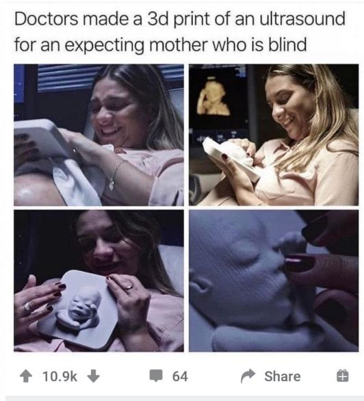 This is a 4-panel collage image capturing a deeply heartwarming moment for a blind expecting mother. The top text overlay reads: 'Doctors made a 3d print of an ultrasound for an expecting mother who is blind'. 

Panel 1: The woman, smiling emotionally, holds the 3D printed model of her fetus against her pregnant belly, connecting with her unborn child through touch.
Panel 2: She sits smiling, holding the model, with an ultrasound display showing the fetus in the background, contextualizing the model's origin.
Panel 3: She leans in, using her fingers to carefully feel the details of the 3D model, her expression full of joy and tenderness.
Panel 4: A close-up shot shows her fingers gently touching the face of the 3D printed fetus, highlighting the intricate details that allow her to 'visualize' her baby through touch.

At the bottom, Reddit interface elements are visible: 10.9k upvotes, 64 comments, and a share button, confirming this is a social media post of this compassionate, inclusive medical act.