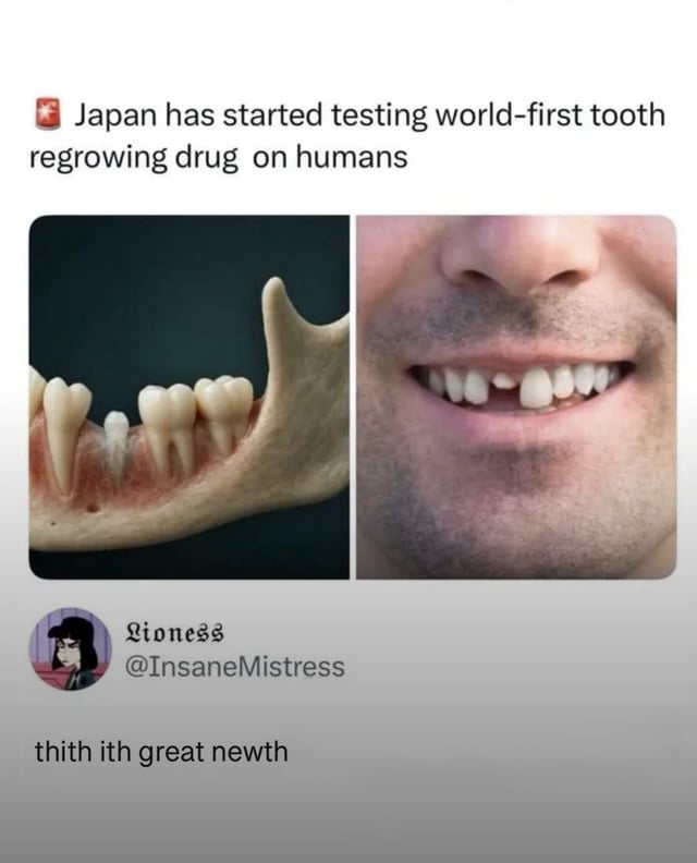 This meme opens with a news headline stating 'Japan has started testing world-first tooth regrowing drug on humans'. Below the headline are two side-by-side images: the left shows a medical model of a lower jaw with a new tooth growing into an empty gap between existing teeth, and the right is a close-up photo of a man smiling, revealing a missing front tooth. Underneath the images is a comment from Twitter/X user @InsaneMistress (display name Lioness) that reads 'thith ith great newth', a phonetic spelling of 'this is great news' written to mimic the lisping speech pattern common for people missing front teeth. The joke relies on the irony that people who stand to benefit most from the tooth regrowing drug would pronounce their excitement about the news with this lisp.
