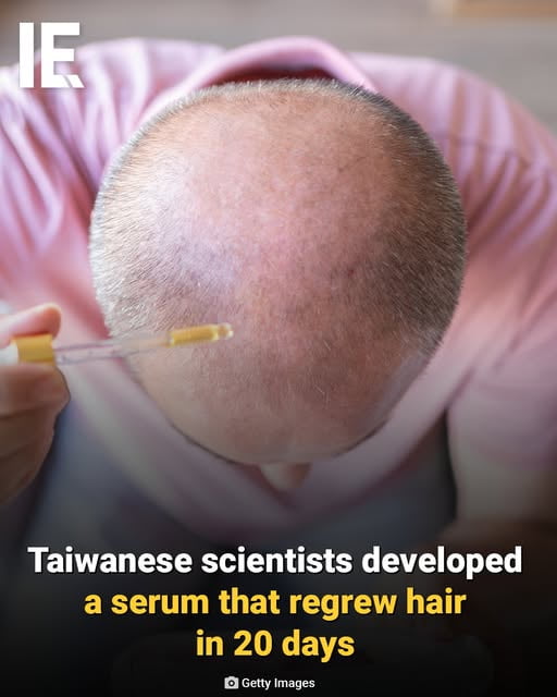 This image shows a close-up top-down view of a balding man's scalp, with a hand holding a dropper full of topical serum positioned to apply it to the bald area. On-image text announces the scientific breakthrough: Taiwanese scientists have developed a new serum that can regrow hair in 20 days, which is exciting promising news for people struggling with hair loss and pattern balding. The research comes from National Taiwan University, where the experimental serum triggered rapid hair growth in test mice within the 20-day timeframe.