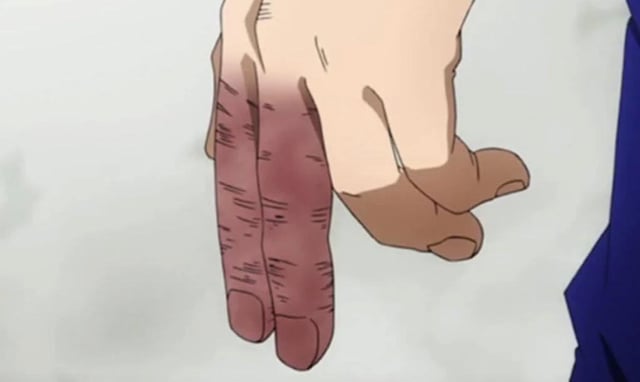This relatable humor meme shows an anime-style hand where the index and middle fingers are dark purple, appearing extremely cold or frostbitten. It is paired with the caption referencing a common childhood experience: when 9 year old children put on winter shoes outside in cold weather, their fingers get very cold while tying laces or adjusting the shoes, leading to discolored, numb fingers after finishing the task. The visual of the discolored fingers comically exaggerates this common, relatable childhood memory for humorous effect.