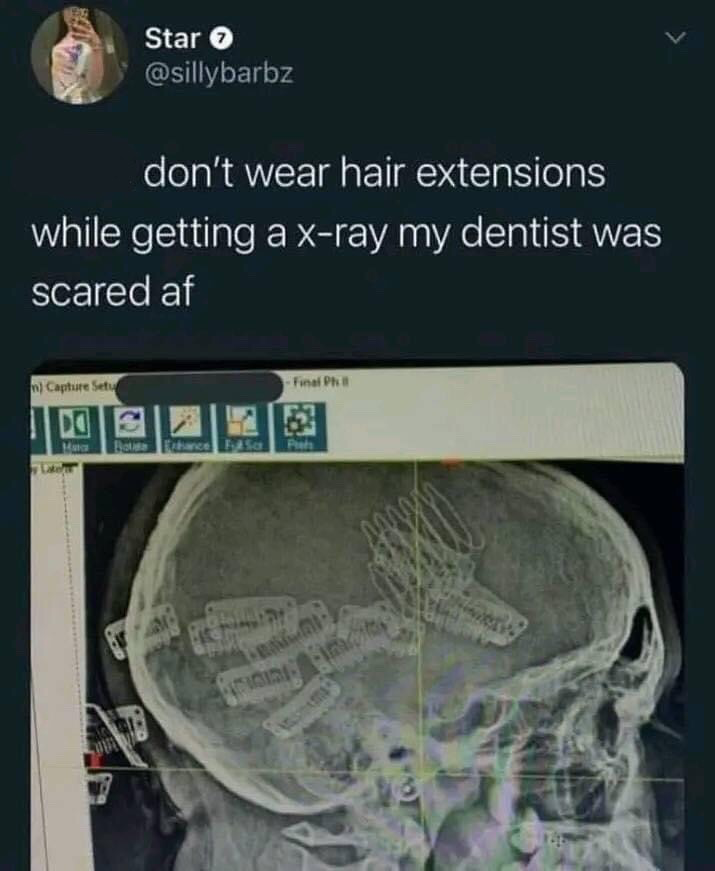 This image is a screenshot of a public post from X (formerly Twitter). The post author warns followers not to wear hair extensions when getting dental x-rays, stating their dentist was extremely scared when they saw the results. The attached x-ray image shows the author's skull, where the metal clips used to attach hair extensions show up as opaque, unusual solid objects that appear to be inside the skull area on the scan, which would look like concerning unexpected foreign material to a dentist at first glance.
