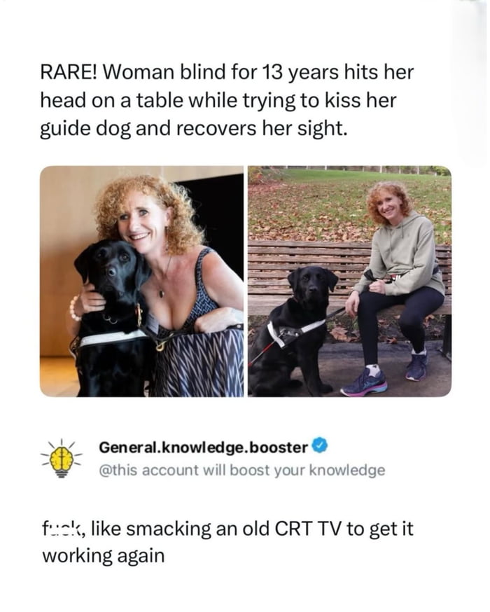 This meme features a viral social media post sharing an unusual real news story: a woman who was blind for 13 years accidentally hit her head on a table while attempting to kiss her guide dog, and unexpectedly regained her sight. The post includes two photos of the smiling woman with her black Labrador guide dog: one indoor photo of her hugging the dog, and one outdoor photo of her sitting on a park bench beside the dog. Below the news post, a humorous quip compares the woman's random head impact fixing her blindness to 'percussive maintenance' -- the common colloquial term for hitting malfunctioning old electronics such as CRT TVs to get them to work temporarily, framing the odd medical event as a funny relatable example of this informal 'fix' working on humans too.