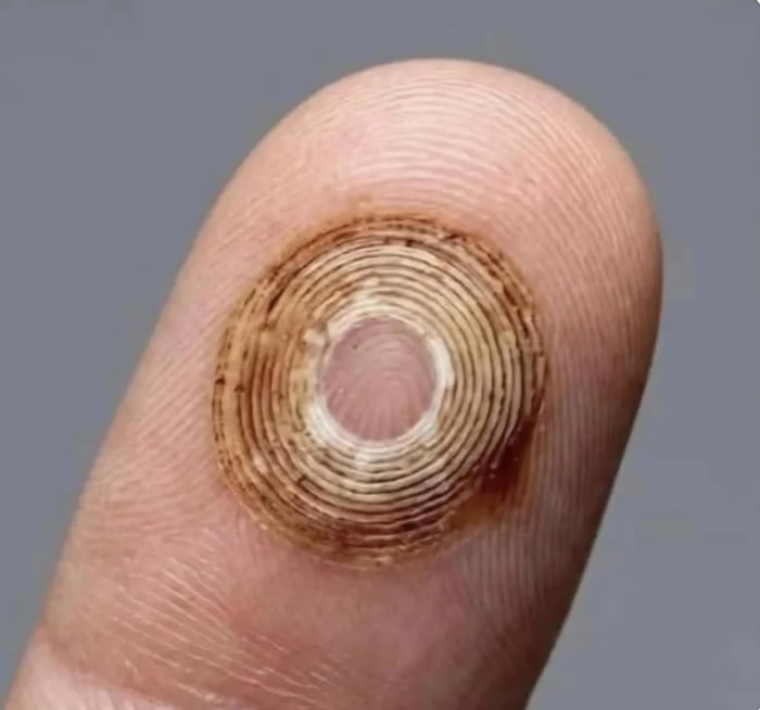 A close-up photograph of a human index finger displaying a distinct circular burn mark with concentric brown and tan rings, resembling tree rings or a target. The burn is centered on the finger pad, with normal skin texture visible around it. The plain gray background emphasizes the finger and the burn, which appears to be a common type of minor injury from the past. The context, suggested by the original title, implies this is an experience (likely accidental cigarette burns) that younger generations may not have encountered, leveraging nostalgia for past common occurrences.