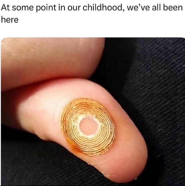 This meme has top text that reads 'At some point in our childhood, we've all been here' placed above a close-up photograph of a human fingertip. The fingertip shows a distinct circular, concentric-ringed brownish mark, which forms when someone repeatedly rubs a pencil eraser against their skin, a very common idle habit many people had as children, especially when bored during school classes. The meme evokes shared, nostalgic recognition of this minor, harmless childhood behavior that most viewers can relate to.
