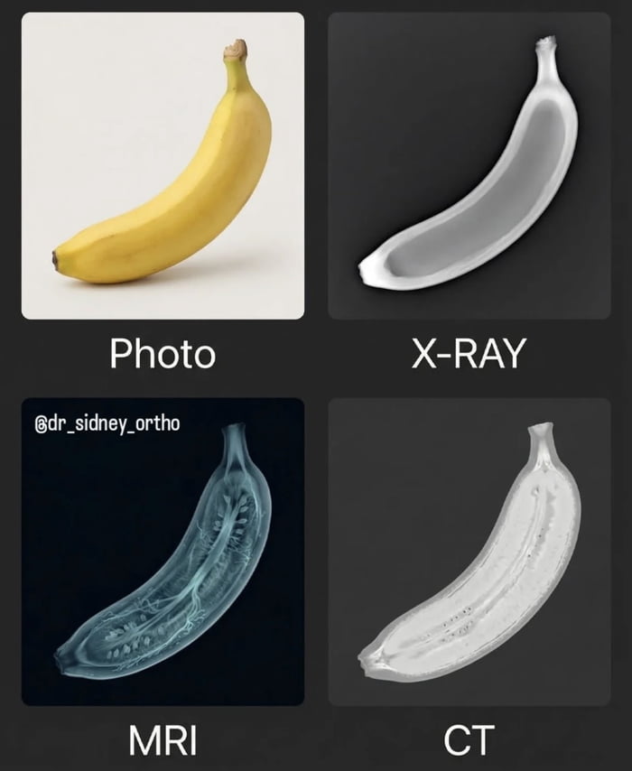 A 2x2 grid image comparing a banana under different medical imaging techniques. Top-left: Color photo of a ripe yellow banana with a curved shape and greenish stem. Top-right: Labeled 'X-RAY', showing a grayscale outline of the banana's external structure. Bottom-left: Labeled 'MRI', featuring a blue-tinted scan revealing internal details like seeds and fibrous structures. Bottom-right: Labeled 'CT', displaying a high-contrast grayscale cross-section of the banana's interior. A watermark '@dr_sidney_ortho' is positioned in the top-left corner of the MRI quadrant. The image humorously applies professional medical imaging modalities to a common fruit, blending education with lightheartedness.