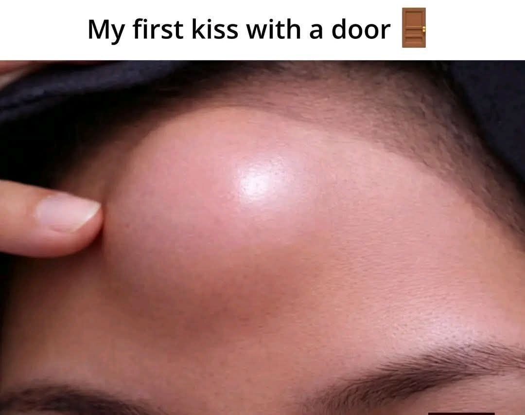 The meme features a close-up shot of a person's forehead with a very large, swollen, raised bump, with one finger pressing gently against the side of the bump. Above the image, text reads "My first kiss with a door" next to a brown door emoji. The humor comes from the sarcastic, lighthearted euphemism that frames the painful, clumsy accident of walking or running straight into a door as a romantic "kiss" to make light of the embarrassing injury.
