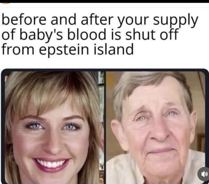 This is a two-panel dark humor meme referencing popular conspiracy theories about Jeffrey Epstein and Epstein Island. The meme jokes about the common false conspiracy claim that wealthy elites connected to Epstein harvest 'baby blood' (or adrenochrome) from infants to maintain youth and reverse aging. The left panel shows a youthful, smiling blonde person edited to look young and feminine as the 'before' state when the baby blood supply is still active. The right panel shows the exact same person edited to look like an elderly man, representing the 'after' state when the supply has been shut off, showing rapid aging as a punchline to the conspiracy joke.