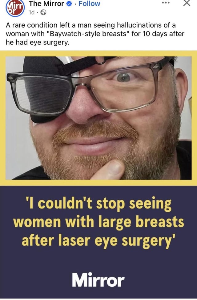 This meme features a screenshot of a social media news post from British tabloid The Mirror, alongside a photo of the male subject of the story. The man, who recently underwent laser eye surgery, wears an eyepatch under his glasses, smirks at the camera, and rests his finger on his chin in a smug, amused expression. The accompanying news text explains that a rare side effect of his surgery left him hallucinating women with large, 'Baywatch-style' breasts for 10 days after the procedure. The humor comes from the contrast between the typical negative side effects patients are warned of before surgery, and this surprisingly desirable, absurd side effect.