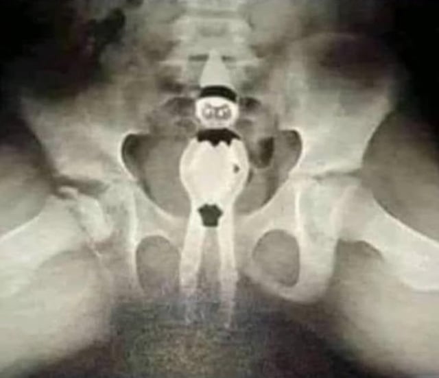 A grayscale X-ray-like image, presumably depicting a pelvic region, with a small, elf-like figure edited into the center. The figure has a round head with visible eyes, a dark upper section resembling a hat, and a light-colored body, creating the illusion of an elf 'inside' the body. This visual joke plays on the phrase 'Elf in myself,' a pun combining 'elf' (the mythical creature) and 'self' (oneself), resulting in a humorous and whimsical meme.