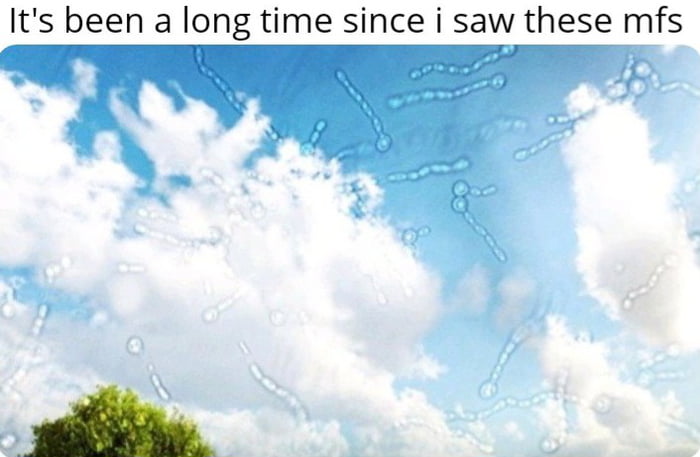 This meme features a photograph of a bright blue sky filled with fluffy white clouds, with the top of a green tree visible in the bottom left corner. Overlaid on the view of the sky are multiple translucent, squiggly string and dot shapes that represent eye floaters, the common harmless visual phenomena people sometimes see when looking at bright, uniform surfaces like the sky. The text at the top of the image uses casual crude internet slang to joke about the relatable experience of unexpectedly noticing eye floaters after going a long period without seeing them.