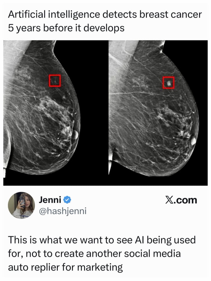 The image is a screenshot of a post from X.com (formerly Twitter) by user Jenni (@hashjenni), who has a verified badge. At the top, there is a text headline: 'Artificial intelligence detects breast cancer 5 years before it develops'. Below the headline, two grayscale mammogram images are displayed side by side, each with a red square highlighting a specific area, presumably indicating early cancer detection by AI. Beneath the images is Jenni's profile section, including her profile picture (a mirror selfie holding a phone), username 'Jenni', verified blue checkmark, handle '@hashjenni', and her comment: 'This is what we want to see AI being used for, not to create another social media auto replier for marketing'. The X.com logo is visible at the bottom right.