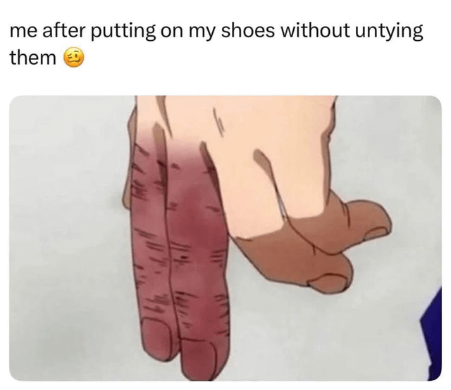 The meme consists of a top text overlay that reads 'me after putting on my shoes without untying them 😬' followed by an animated image of a hand. The hand displays two prominently red, swollen fingers, visually representing the discomfort or pain of forcing one's feet into shoes without untying the laces. The humor stems from the relatable everyday experience of rushing to put on shoes and the resulting physical discomfort, exaggerated through the swollen fingers in the animated hand.