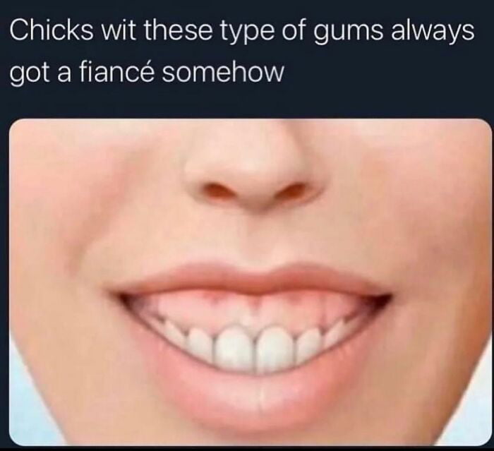 This meme features a close-up, slightly uncanny-looking image of a person's mouth displaying a prominent gummy smile, paired with the top text: "Chicks wit these type of gums always got a fiancé somehow". The joke is a playful, lighthearted observational meme centered on an absurd, unspoken internet stereotype that women with this specific gummy smile appearance often seem to be engaged. It leans into casual, teasing humor about physical traits and relationship statuses, presenting a random, relatable (to internet culture) generalization meant for comedic effect rather than factual accuracy.