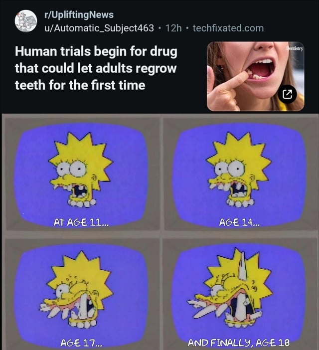 This meme combines a screenshot of a science news post from Reddit with an edited 4-panel comic of Lisa Simpson from The Simpsons for comedic effect. The top section shows a Reddit post announcing that human trials have begun for an experimental drug that would allow adults to regrow lost teeth. The bottom 4-panel edit shows Lisa Simpson aging from 11 to 18 years old, with each panel showing progressively more teeth growing in her mouth, ending with a giant single enormous tooth bursting out of her jaw at age 18. The joke exaggerates the effect of the new drug for absurdist humor, matching the original title 'Me in real life' by framing it as the poster's own hypothetical outcome with the new drug.