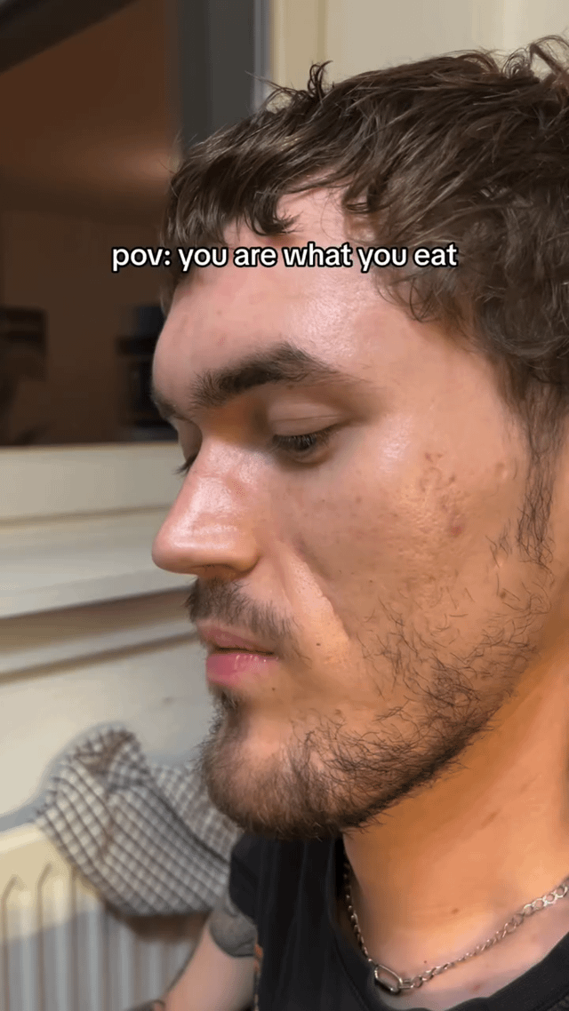 A close-up photograph of a young man with curly hair, light facial hair, and visible acne, looking downward to his left. The image includes a text overlay at the top that reads 'pov: you are what you eat,' playing on the common proverb to humorously suggest a literal connection between diet and physical appearance. The background is a blurred indoor setting with a white wall and a checkered object partially visible, keeping focus on the subject's face.