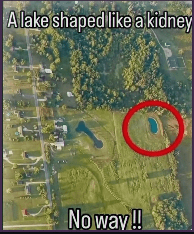 This is an aerial top-down photograph of a rural suburban area, showing residential houses lined along a road, grassy fields, forested areas, and two small man-made lakes. White text at the top of the image reads 'A lake shaped like a kidney', a bold red circle is drawn to highlight the smaller, bright blue lake on the right side of the frame which bears an extremely close, uncanny resemblance to the shape of a human kidney. White text at the bottom reads 'No way!!', expressing exaggerated, comedic shock at the perfect, unexpected match of the lake's shape to a kidney. The humor of the meme comes from the absurdly perfect odd coincidence of the lake's shape.