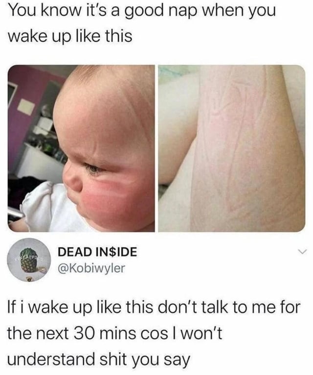 This is a relatable two-panel meme about the experience of taking a very deep, long nap. At the top of the image is text that reads 'You know it's a good nap when you wake up like this'. The left panel shows a real photo of a baby with a large, deep red sleep wrinkle imprinted on its cheek from pressing against a surface while napping. The right panel shows a close-up of an adult's arm with an identical-looking deep sleep wrinkle, showing that adults experience the same thing after a long nap. Below the panels is a screenshot of a tweet from user 'DEAD IN$IDE' (@Kobiwyler) that adds the caption: 'If i wake up like this don’t talk to me for the next 30 mins cos I won’t understand shit you say'. The joke compares how both babies and adults look and feel after a really deep nap, highlighting the post-nap grogginess that leaves you disoriented and unable to interact properly for a while after waking up, framing the deep nap as a full system restart for the body and brain.