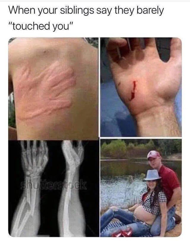 A four-panel collage meme humorously exaggerating the phrase 'barely touched you' often used by siblings. Top-left panel shows a person's back with prominent red handprint marks, implying a forceful push. Top-right panel displays a hand with a small, shallow cut, suggesting minor injury. Bottom-left panel is an X-ray image of a broken wrist, escalating the severity. Bottom-right panel features a pregnant woman sitting with a man by a lake, implying an extreme, absurd outcome of 'barely touching' (i.e., conception). The meme uses escalating visual gags to讽刺 siblings downplaying their actions.