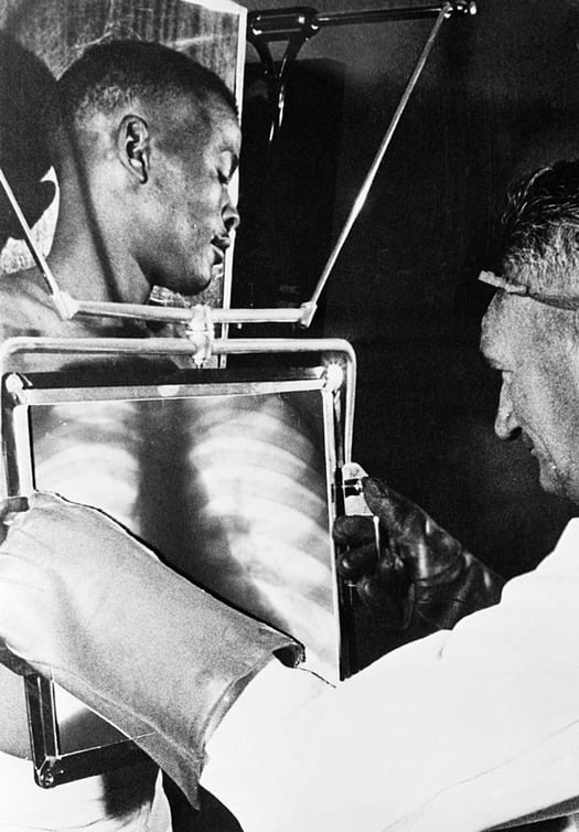 A black and white historical photograph depicting a medical professional examining a chest X-ray image while another person stands positioned at an X-ray machine. The doctor wears a white coat and protective gloves, holding the X-ray up to view the ribcage structure. The second individual has their chest area aligned with what appears to be an early X-ray imaging device. The image captures a moment from medical history showing radiology practices, likely from the mid-20th century.