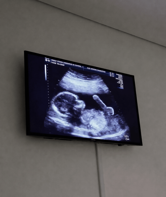 Real prenatal ultrasound